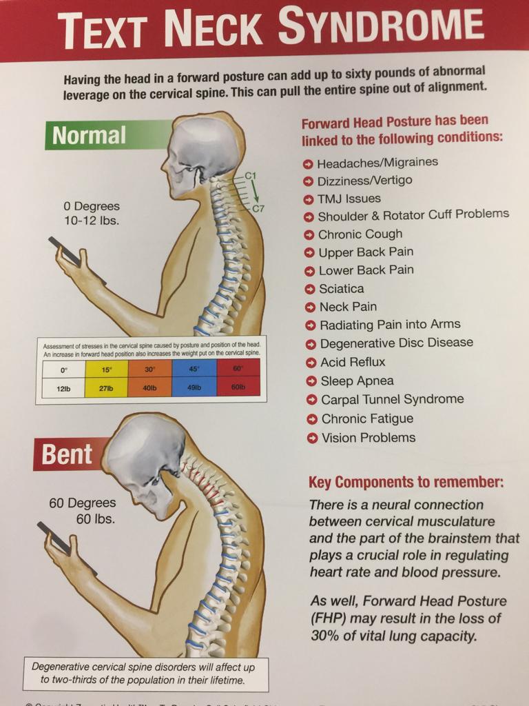 The neck syndrome