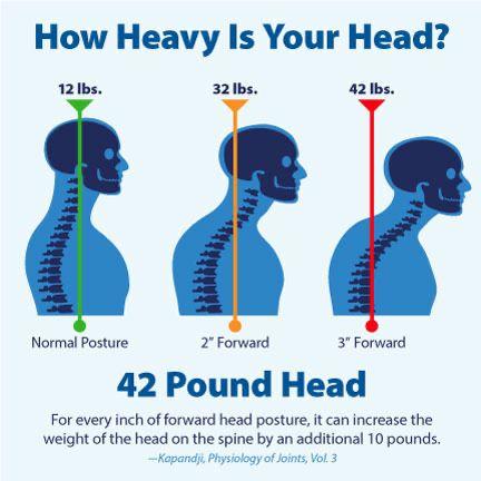 Forward Head Posture