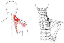 Overloaded head posture